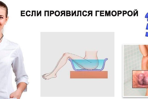 Кракен гидра